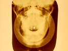 USSR X-RAY SKULL ROENTGEN BONES RECORD ORIGINAL OLD RIBS 970
