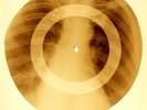 X-RAY USSR ROENTGEN BONES RECORD ORIGINAL OLD RIBS 15
