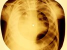 X-RAY CHILD USSR ROENTGEN BONES RECORD ORIGINAL OLD RIBS 986