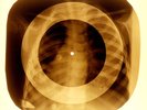 BUTTONS X-RAY CHILD USSR ROENTGEN BONES RECORD ORIGINAL OLD RIBS 977