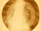 X-RAY USSR ROENTGEN BONES RECORD ORIGINAL OLD RIBS 9