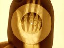 USSR X-RAY HAND ROENTGEN BONES RECORD ORIGINAL OLD RIBS 52