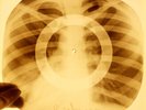 X-RAY USSR ROENTGEN BONES RECORD ORIGINAL OLD RIBS 53