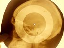 USSR X-RAY SKULL ROENTGEN BONES RECORD ORIGINAL OLD RIBS 63