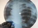 PINK FLOYD ASTRONOMY DOMINO X-Ray USSR Record Roentgen Bone Ribs Music Vinyl