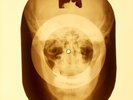 USSR X-RAY SKULL ROENTGEN BONES RECORD ORIGINAL OLD RIBS 81