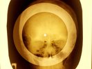 USSR X-RAY SKULL ROENTGEN BONES RECORD ORIGINAL OLD RIBS 84