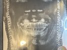 Travis Scott Utopia Vinyl Cover 5 NEW Sealed Vinyl  IN HAND READY TO SHIP