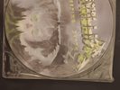 Metallica – Creeping Death RARE PICTURE DISC VINYL EP 1984 UK