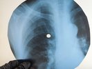 BEATLES WHILE MY GUITAR GENTLY X-Ray USSR Record Roentgen Bone Ribs Music Vinyl
