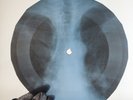 LED ZEPPELIN FRIENDS X-Ray USSR Record Roentgen Bone Ribs Music Vinyl