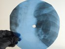 DAVID BOWIE SILLY BOY BLUE X-Ray USSR Record Roentgen Bone Ribs Music Vinyl