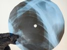 PINK FLOYD ASTRONOMY DOMINO X-Ray USSR Record Roentgen Bone Ribs Music Vinyl