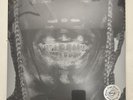 Travis Scott ‎– Utopia Cactus Jack ‎– 2 × Vinyl, Silver Translucent, Cover 5 US