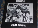 BURIED TREASURE / THE BEATLES 1975 WONDERLAND 2XLP WL 49001