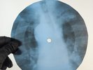 MONKEES PORPOISE SONG X-Ray USSR Record Roentgen Bone Ribs Music Vinyl