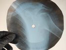 DAVID BOWIE THE MAN WHO SOLD X-Ray USSR Record Roentgen Bone Ribs Music Vinyl