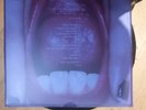 Olivia Rodrigo - Guts (Spilled) (2024) - 2x Vinyl, LP, Marble Vinyl