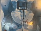 Lorde SIGNED VIRGIN GATEFOLD X-RAY PICTURE DISC VINYL + OR 3 Presale Bundle