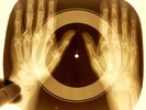 USSR X-RAY BONES RIBS VINTAGE UNIQUE ITEM RECORD 142 FOLK