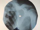BLACK SABBATH ELECTRIC FUNERAL X-Ray USSR Record Roentgen Bone Ribs Music Vinyl