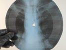GEORGE HARRISON MY SWEET LORD X-Ray USSR Record Roentgen Bone Ribs Music Vinyl