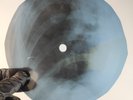 ELVIS PRESLEY IN THE GHETTO X-Ray USSR Record Roentgen Bone Ribs Music Vinyl
