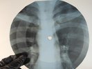 BEATLES WHILE MY GUITAR GENTLY X-Ray USSR Record Roentgen Bone Ribs Music Vinyl