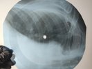 DAVID BOWIE SILLY BOY BLUE X-Ray USSR Record Roentgen Bone Ribs Music Vinyl