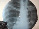 LED ZEPPELIN RAMBLE ON X-Ray USSR Record Roentgen Bone Ribs Music Vinyl
