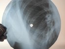 LED ZEPPELIN HEY HEY WHAT CAN I X-Ray USSR Record Roentgen Bone Ribs Music Vinyl