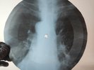 BEATLES WHILE MY GUITAR GENTLY X-Ray USSR Record Roentgen Bone Ribs Music Vinyl