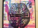 2011 New Found Glory - Radio Surgery - Pink Vinyl