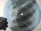 LED ZEPPELIN COMMUNICATION BREA X-Ray USSR Record Roentgen Bone Ribs Music Vinyl