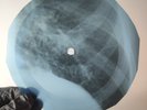LED ZEPPELIN IMMIGRANT SONG X-Ray USSR Record Roentgen Bone Ribs Music Vinyl