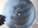 LED ZEPPELIN FRIENDS X-Ray USSR Record Roentgen Bone Ribs Music Vinyl