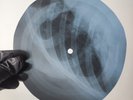 FITZGERALD LULLABY OF BIRDLAND X-Ray USSR Record Roentgen Bone Ribs Music Vinyl