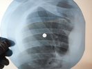 FOUR TOPS BERNADETTE X-Ray USSR Record Roentgen Bone Ribs Music Vinyl